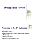 5th Metatarsal Fractures