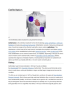 implantable cardioverter defibrillator for sale